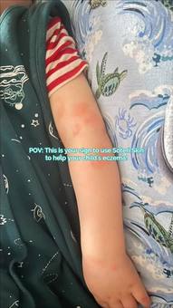 Ad by SOTERI SKIN